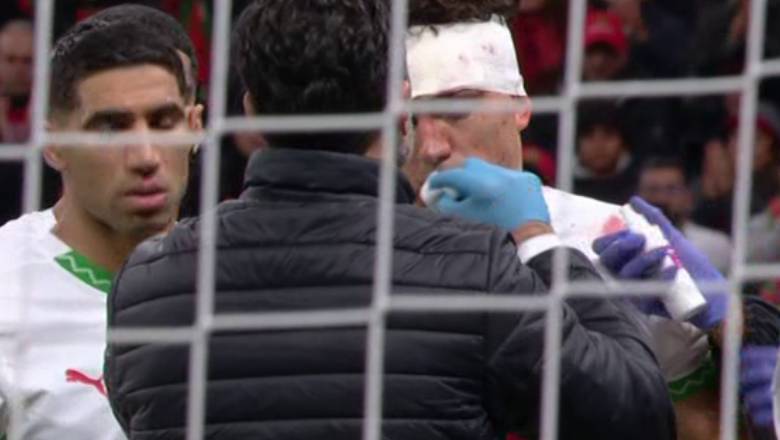 Morocco star Neil El Aynaoui continues playing in AFCON 2025 final despite serious bleeding head wound - Ảnh 1